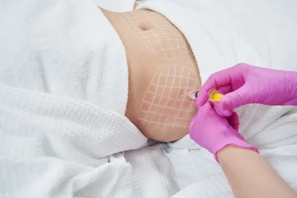 image of fat dissolving injections on love handles to help combat weight gain Hall Green