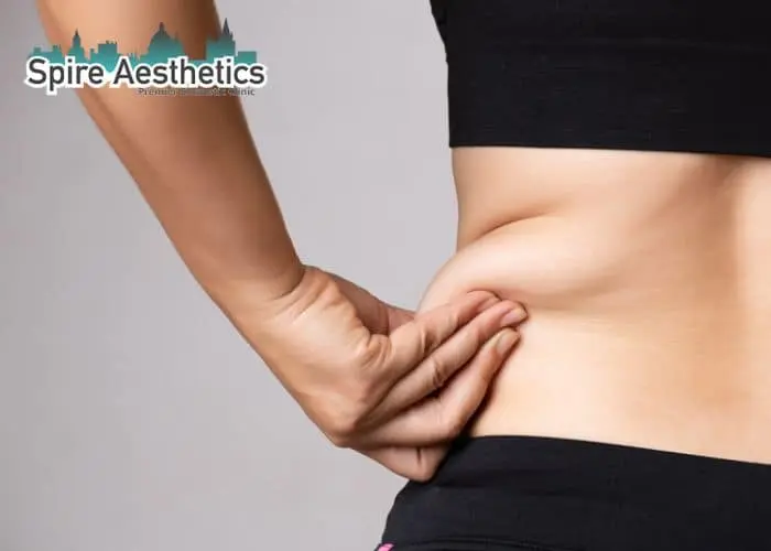 Image of woman pinching fat on their hips Hall Green. Fat Freezing treatment