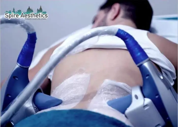 Man having fat freezing treatment done on love handles before a competitions Hall Green to create a sculpted look.