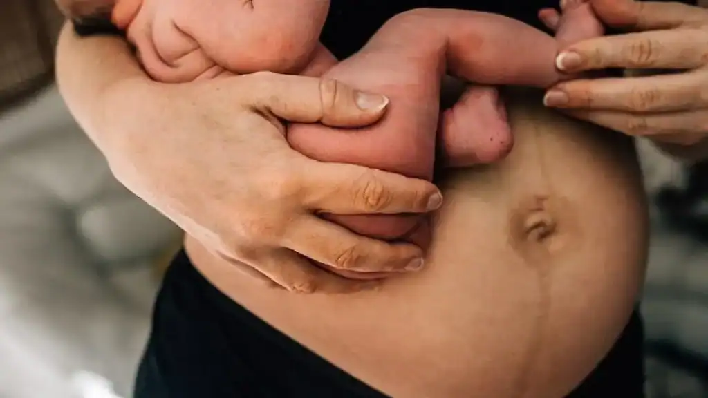 Why Is My Stomach Still Big After Pregnancy Hall Green?